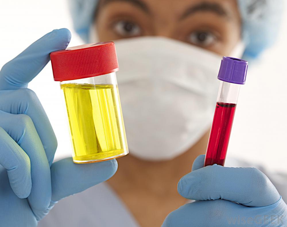 Analisi del sangue e urine a Correggio da MedicalPro a 35 €