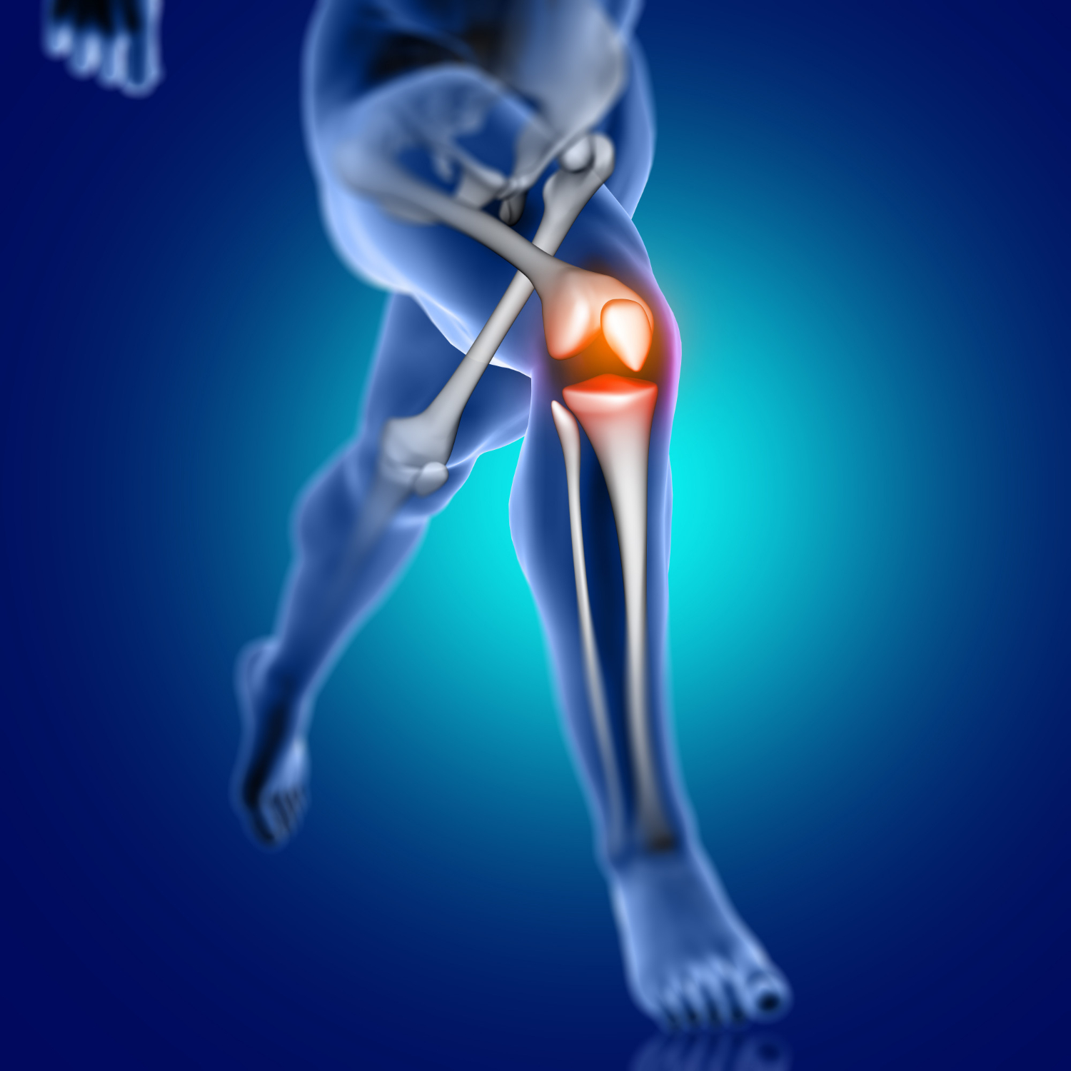 operazione protesi ginocchio: costi, fisioterapia e riabilitazione a Correggio.