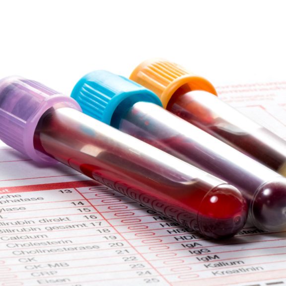 esami del sangue e delle urine a correggio