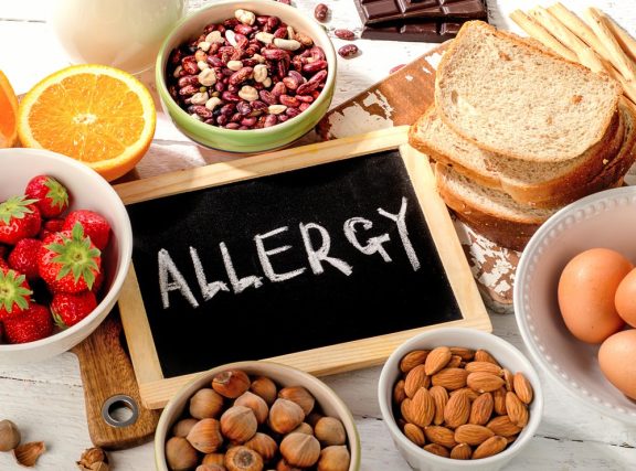 test allergie alimentari e respiratorie Alex2 a Correggio presso il poliambulatorio MedicalPro